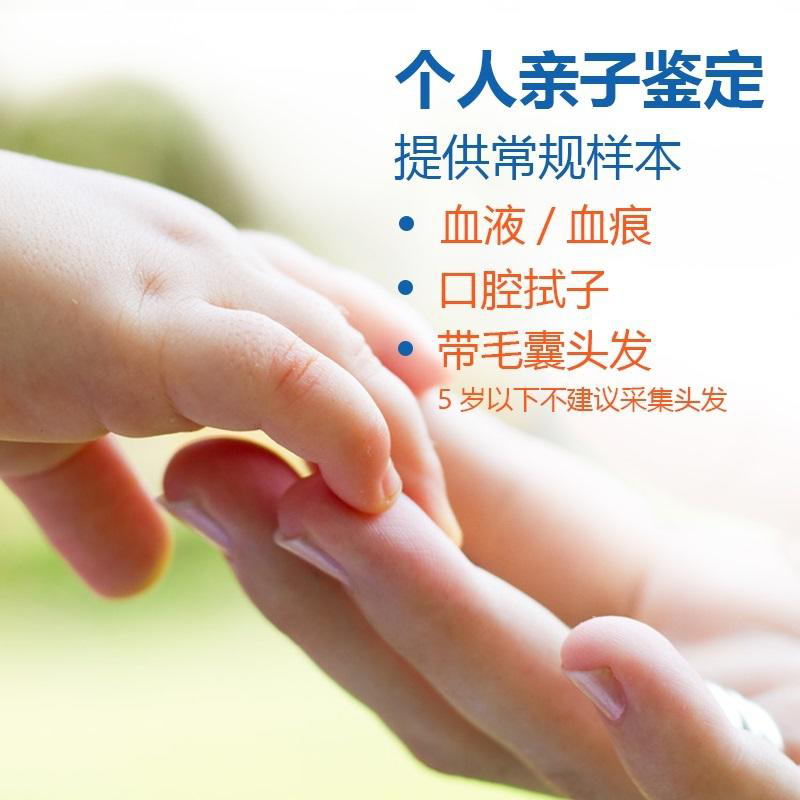 哈尔滨毛发能做DNA鉴定吗,隐私亲子鉴定大概收费