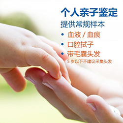 哈尔滨毛发能做DNA鉴定吗，隐私亲子鉴定大概收费
