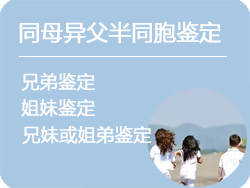 哈尔滨同母异父半同胞鉴定